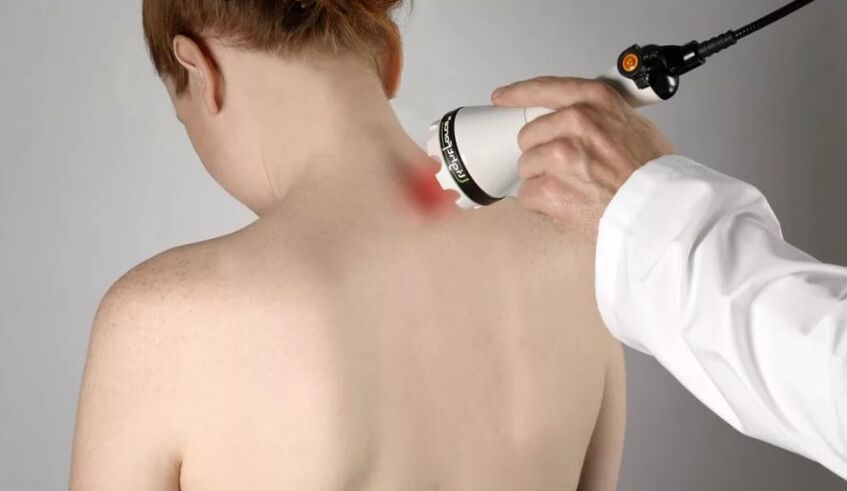 Physiotherapeutic method of cervical osteochondrosis treatment