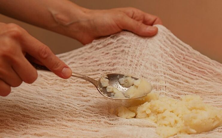 Preparing a compression by potatoes